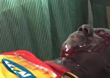 Video: Watch Kotoko fan shot by Police after Berekum Chelsea loss lying helplessly in a pool of blood